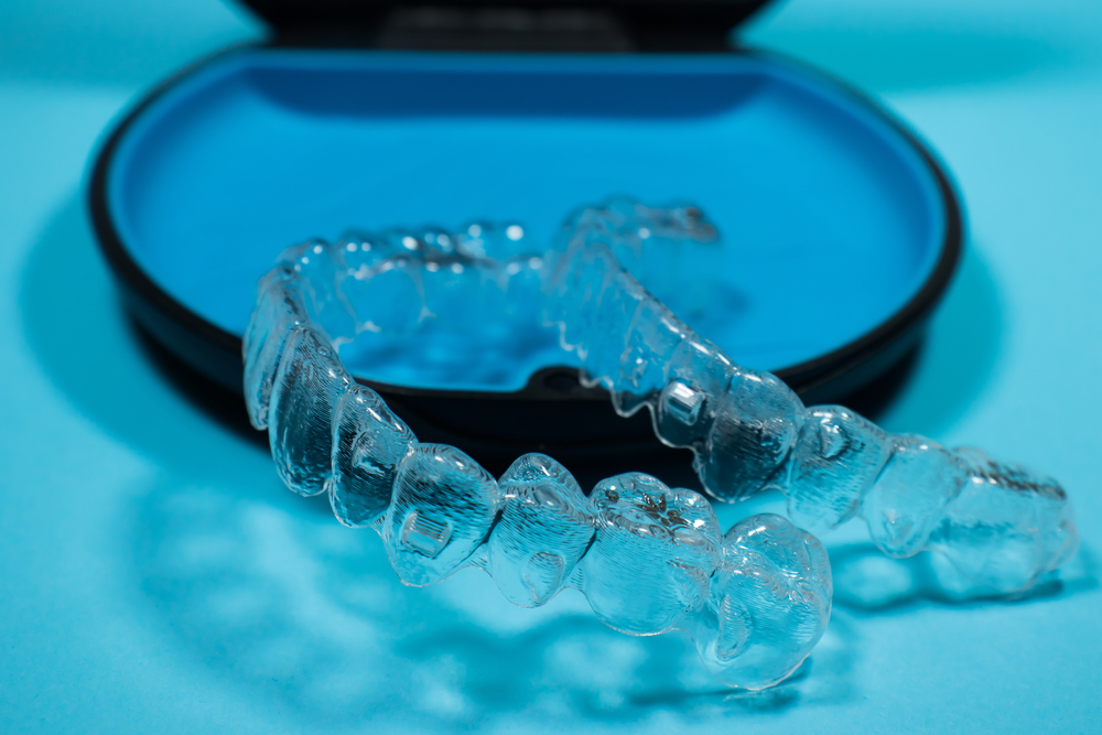 invisalign for overbites